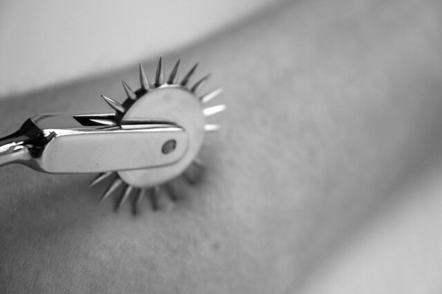 Wartenberg pinwheel in use